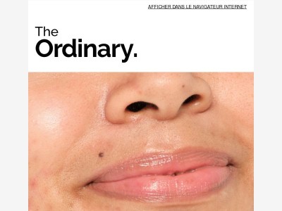 Pores et imperfections : quoi de plus normal ?