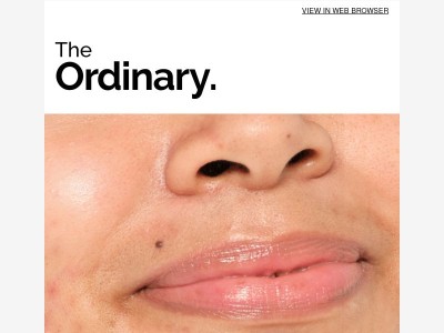 Pores are normal. Breakouts are, too.